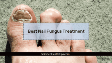 Best Nail Fungus Treatment