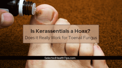 Is Kerassentials a Hoax - Does it Really Work for Toenail Fungus
