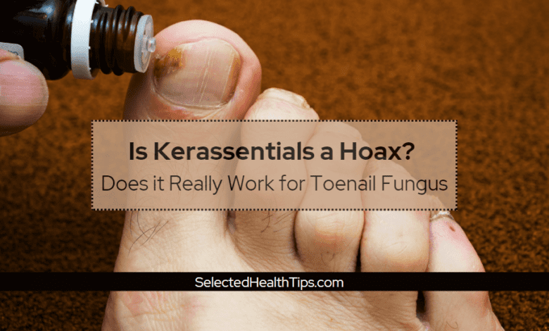 Is Kerassentials a Hoax - Does it Really Work for Toenail Fungus